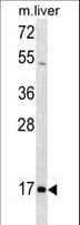 HOXA1 Antibody (aa9-35)