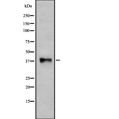 Polyclonal Rabbit anti-Human P2Y10 / P2RY10 Antibody (aa133-152, IHC, IF, WB)