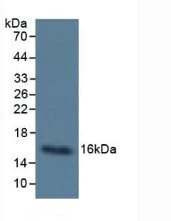 CST3 / Cystatin C Antibody (PE)