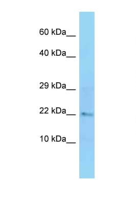 CFL2 / Cofilin 2 Antibody (C-Terminus)