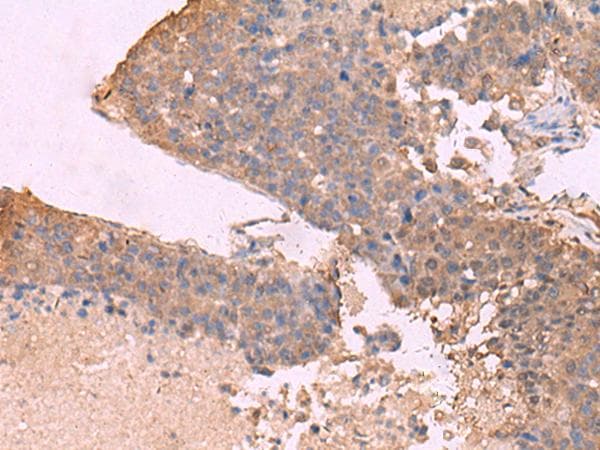 KCNU1 / KCNMC1 Antibody