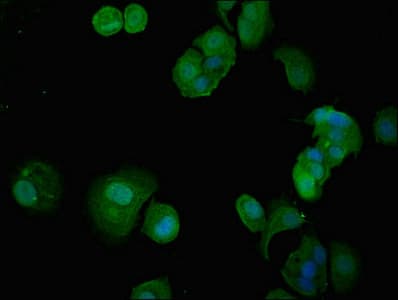 ITGA5/Integrin Alpha 5/CD49e Antibody