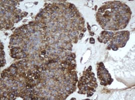 EPHX1 / Epoxide Hydrolase 1 Antibody (aa21-230, clone OTI3F11, Carrier-free)