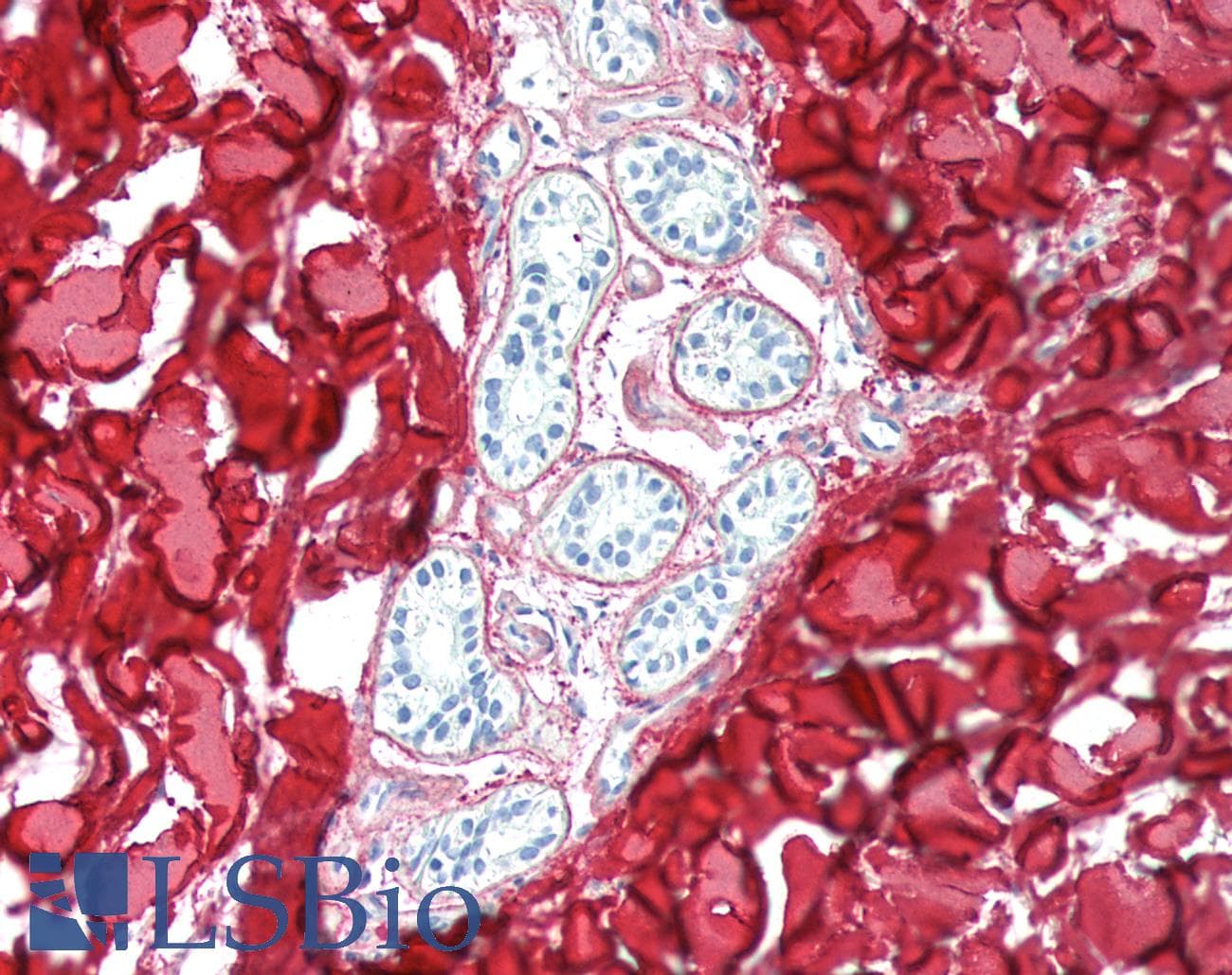 PathPlus™ COL3A1 / Collagen III Antibody