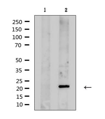 KCNMB1 Antibody