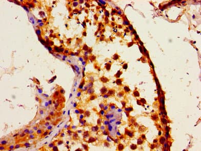 ITPR1 / IP3 Receptor Type 1 Antibody