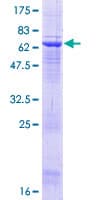 Human ACTL8 Protein (Recombinant GST)