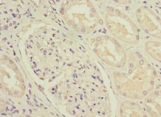Polyclonal Rabbit anti-Human NDUFS3 Antibody (IHC, IF, WB)