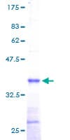 Human DAD1 Protein (Recombinant GST)