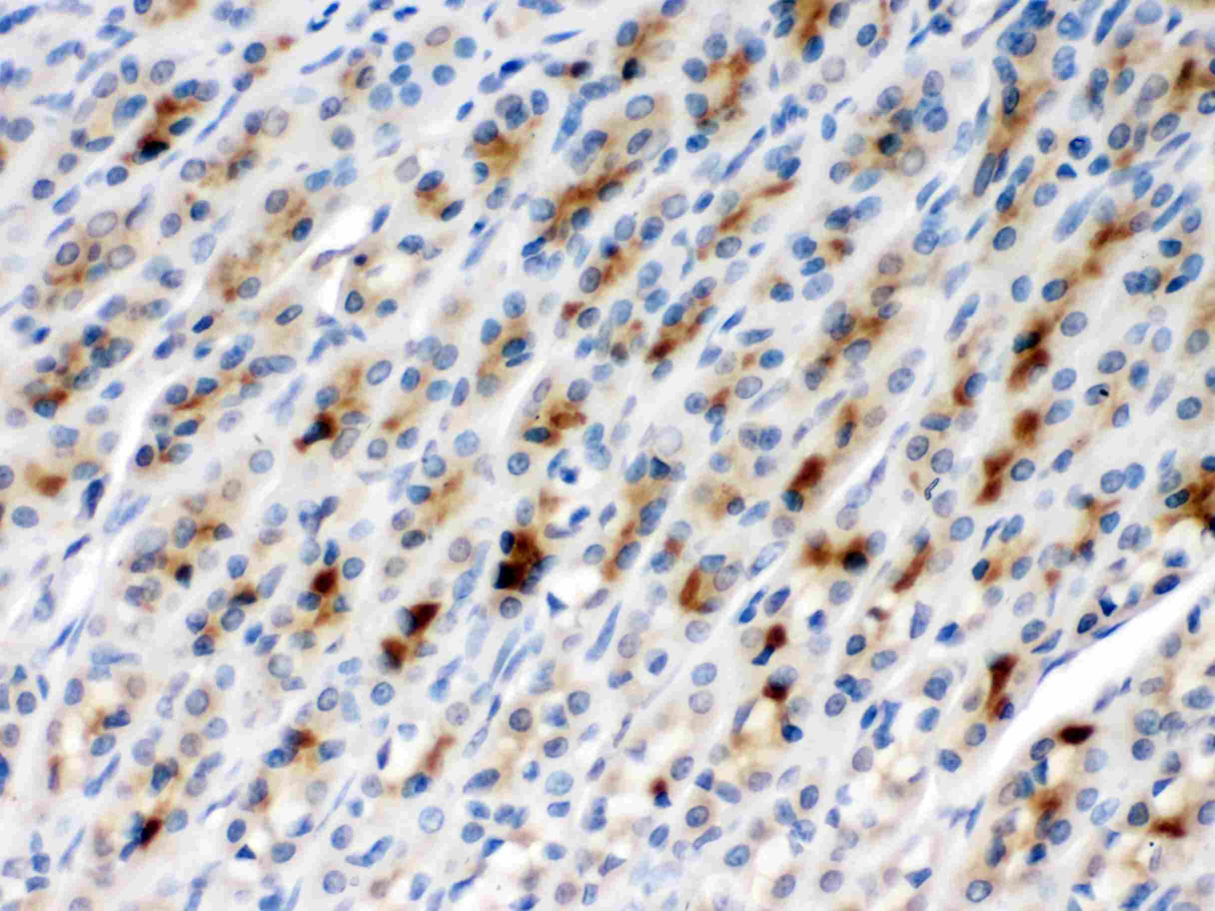 CCT2 / CCT Beta Antibody