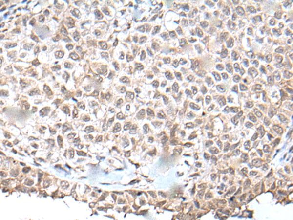 Polyclonal Rabbit anti-Human UBN1 / Ubinuclein 1 Antibody (IHC)