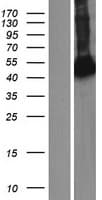 ARHGAP8 Protein (Over-Expression Lysate Myc-DDK (Flag))