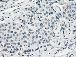 SSX2 Antibody (clone OTI4A11)