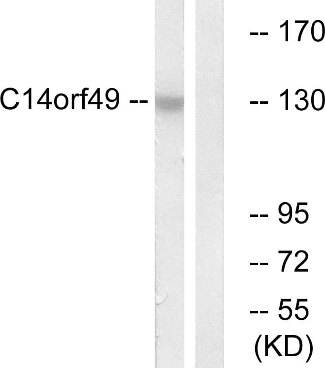 IHC-plus™ Polyclonal Rabbit anti-Human SYNE3 / C14orf49 Antibody (aa169-218, IHC, WB)