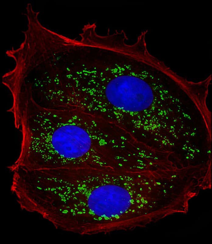 TFF1 / pS2 Antibody (Internal)