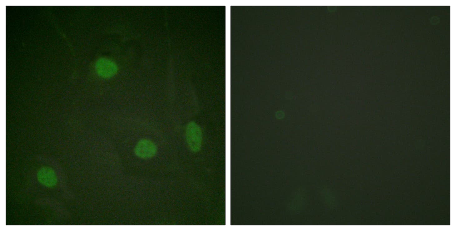 Histone H3 Antibody (Acetyl-Lys23)