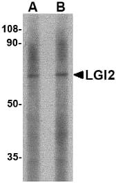 IHC-plus™ LGI2 Antibody