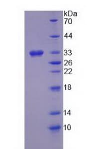 Human HSD17B3 Protein (Recombinant)