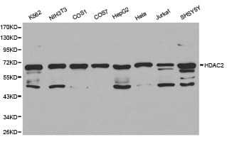 Polyclonal Rabbit anti-Human HDAC2 Antibody (IHC, WB)