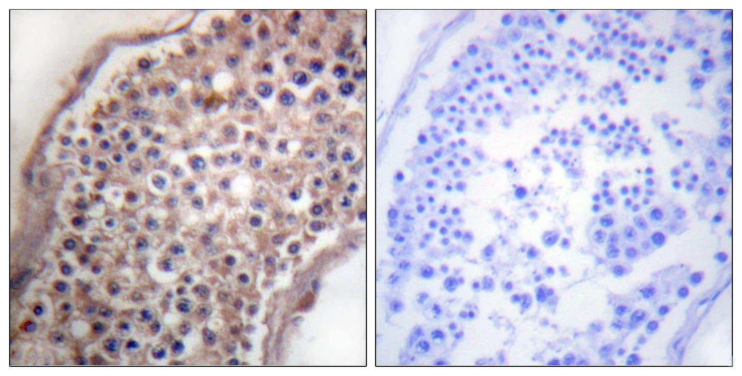 Polyclonal Rabbit anti-Human Ephrin B1+B2 Antibody (aa284-333, IHC, WB)
