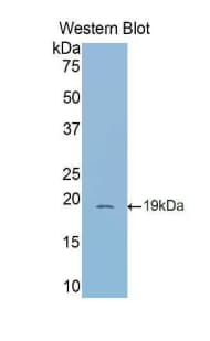 DPP4 / CD26 Antibody (aa638-767, Cy3)