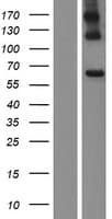 Human AOAH / Acyloxyacyl Hydrolase Protein (Over-Expression Lysate Myc-DDK (Flag))