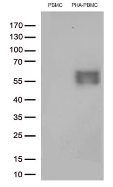 PDCD1 / CD279 / PD-1 Antibody (clone UMAB198)