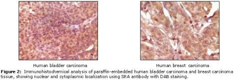 Monoclonal Mouse anti-Human SRA1 / SRA Antibody (clone 7H1G1, IHC, WB)