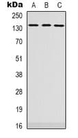 Polyclonal Rabbit anti-Human PLEKHG4 Antibody (Internal, IHC, WB)
