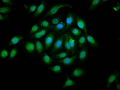 EPHA2 / EPH Receptor A2 Antibody