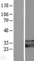 SARAF / TMEM66 Protein (Over-Expression Lysate Myc-DDK (Flag))