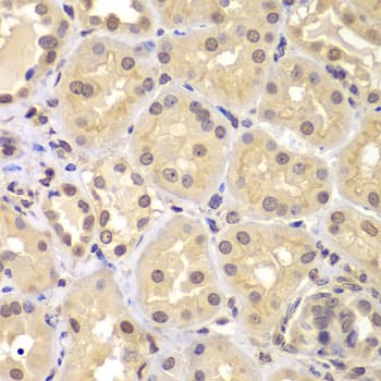 Polyclonal Rabbit anti-Human KPNA6 Antibody (IHC, WB)