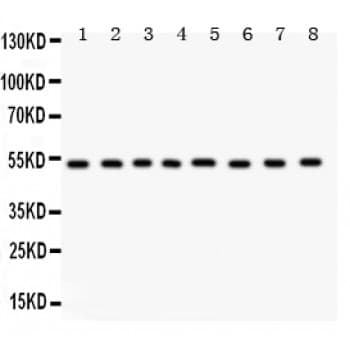 WAS / WASP Antibody (aa129-156)