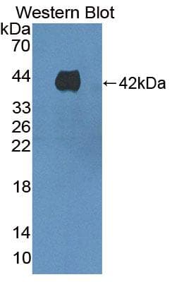 HAVCR1 / KIM-1 Antibody (aa5-107)