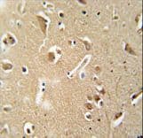 CILP2 Antibody (aa825-852)