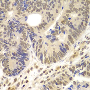 LHX4 Antibody