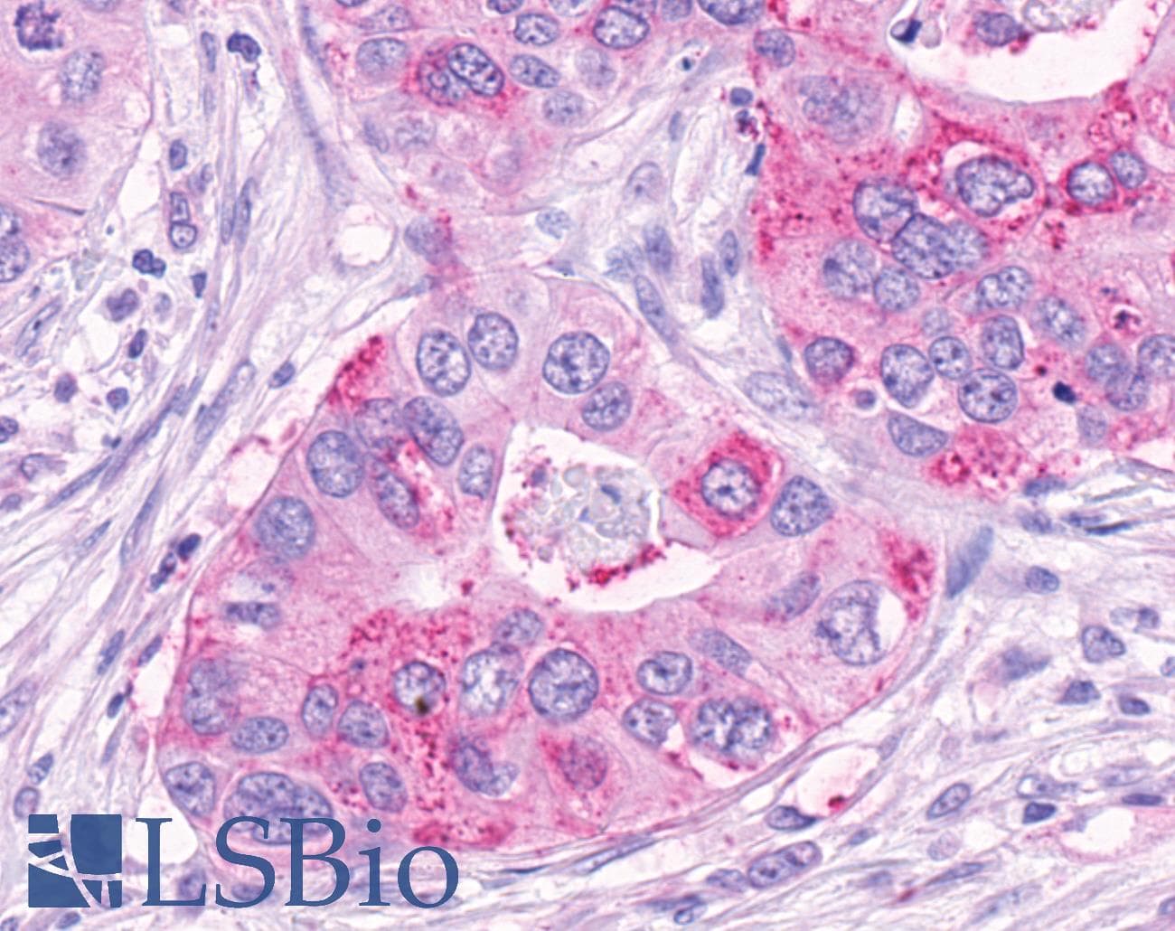 IHC-plus™ NPFF2 / NPFFR2 Antibody (Extracellular Domain)