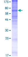 Human MBOAT5 / C3F Protein (Recombinant GST)