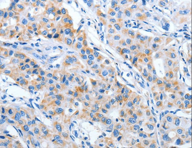 IMMT / Mitofilin Antibody