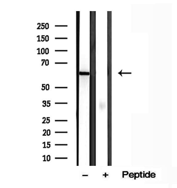 PFK2 / PFKFB3 Antibody