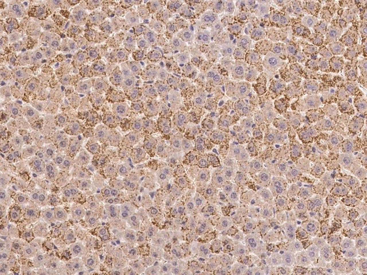 PTPN2 / TC-PTP Antibody (Preservative Free)