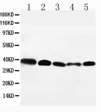 CCR10 / GPR2 Antibody (aa312-327)