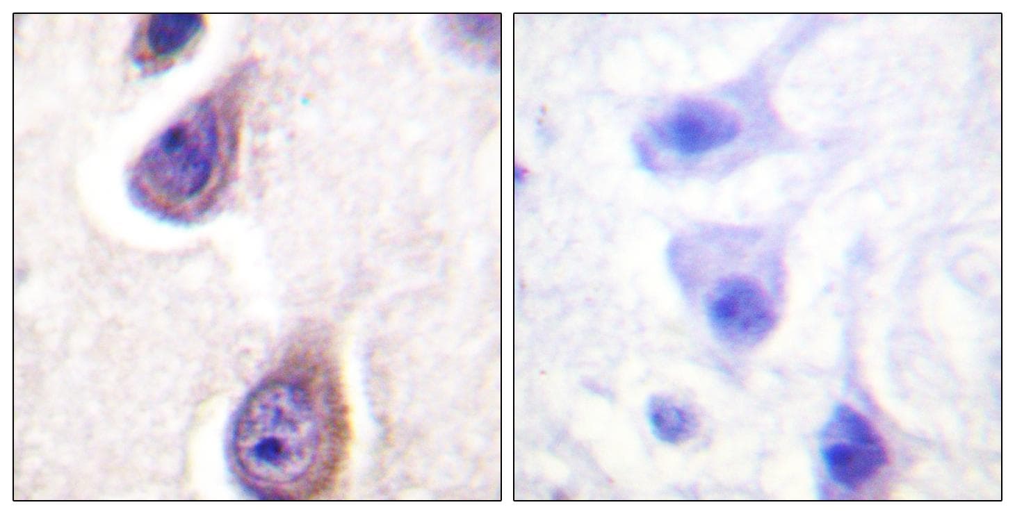 PLD1 / Phospholipase D1 Antibody (phospho-Ser561)