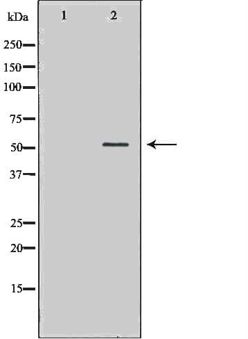 DES / Desmin Antibody