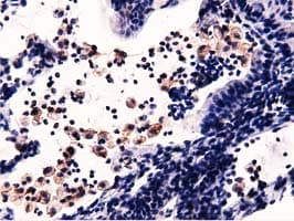 MICAL1 / MICAL Antibody (clone OTI4A1)