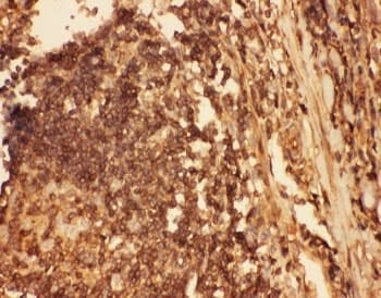 CFL1 / Cofilin Antibody (aa2-166)