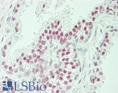 IHC-plus™ Polyclonal Rabbit anti-Human FLJ12529 / CPSF7 Antibody (aa175-225, IHC, IF)
