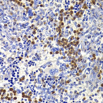 IL21 Antibody