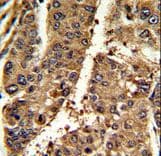 Polyclonal Rabbit anti-Human PSME2 Antibody (aa210-239, IHC, WB)