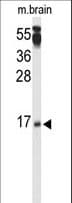 Polyclonal Rabbit anti-Human PPP3R2 Antibody (aa3-29, IHC, WB)